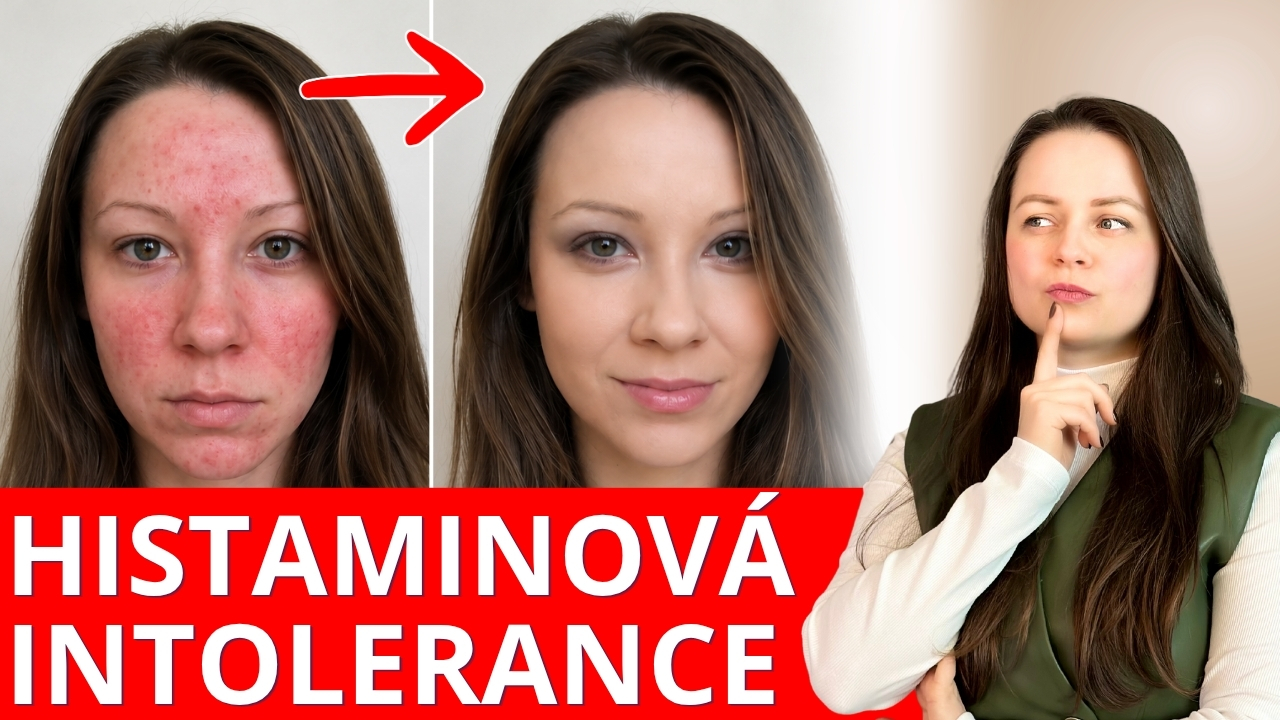 HISTAMINOVÁ INTOLERANCE - jak se stravovat? Alergie nebo histamin?