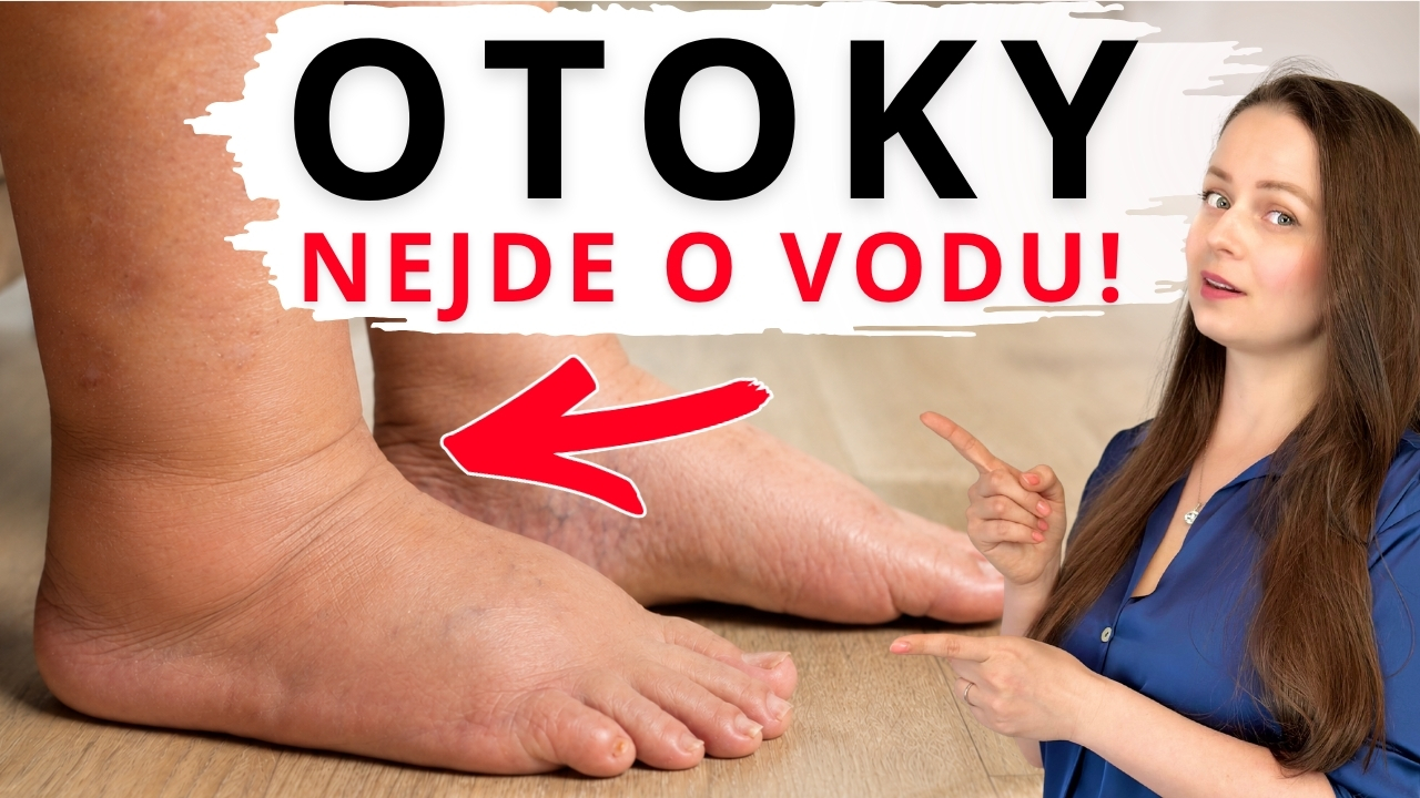 OTÉKAJÍ VÁM NOHY? Udělejte toto a pocítíte rozdíl