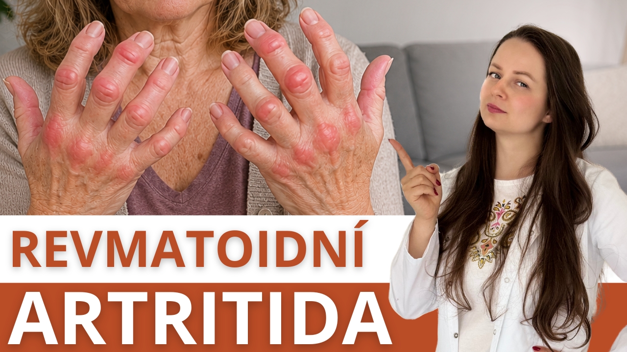  Prostředek, který opravdu pomáhá při REVMATOIDNÍ ARTRITIDĚ (a není to vitamín D)